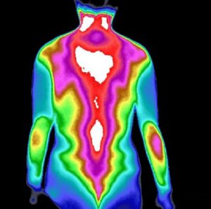 中医个性化体检健康评估丨KIR医用红外热成像，5分钟完成一次全身检查！