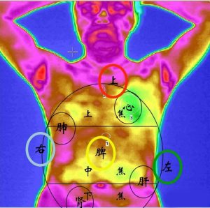 两张红外热成像热图让你读懂自已的体质