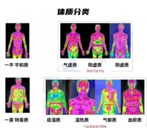智能红外热成像检测，先辨体质再艾灸为您精准调理亚健康问题
