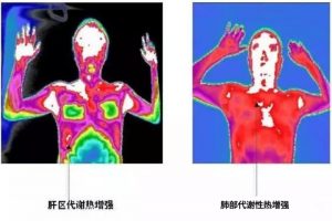 远红外热成像技术在健康评估体检中有哪些应用范围？