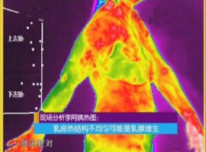 红外热像仪的医学应用，不健康的人体热像图是怎样的？