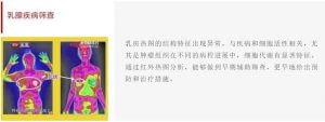“红外热成像+医疗”的应用展示？第十二届广州国际中医养生及理疗产品暨中医馆加盟展览会