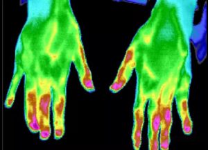 生命热图–医用红外热成像系统