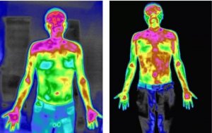 红外热成像应用于健康测评指导理疗调理效果跟踪