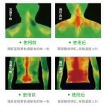 中医调理健康管理丨华景康红外热成像产品在艾灸/灸疗领域的应用 中医调理健康管理丨华景康红外热成像产品在艾灸/灸疗领域的应用