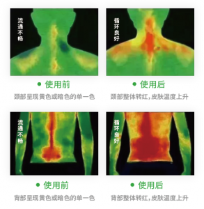 中医调理健康管理丨华景康红外热成像产品在艾灸/灸疗领域的应用 中医调理健康管理丨华景康红外热成像产品在艾灸/灸疗领域的应用