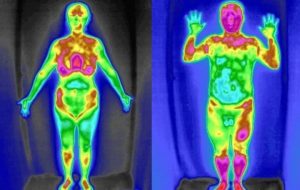 红外热成像技术在中医脏腑研究浅析