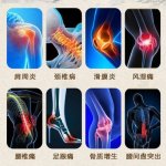 伤筋还是动骨,如何治?医用红外热成像“一眼看穿”病源所在 伤筋还是动骨,如何治?医用红外热成像“一眼看穿”病源所在