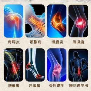 伤筋还是动骨，如何治？医用红外热成像“一眼看穿”病源所在