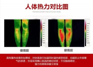 医用红外热成像技术加持热疗—用温度感知健康，让疾病无处可藏