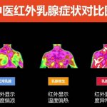 医用红外热成像技术与健康分析评估 医用红外热成像技术与健康分析评估