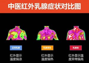 医用红外热成像技术与健康分析评估 医用红外热成像技术与健康分析评估