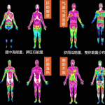 你对医用红外热成像了解多少? 你对医用红外热成像了解多少?