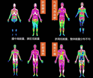 你对医用红外热成像了解多少? 你对医用红外热成像了解多少?