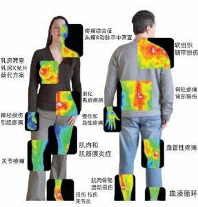 医用红外热成像在临床科室的应用 医用红外热成像在临床科室的应用