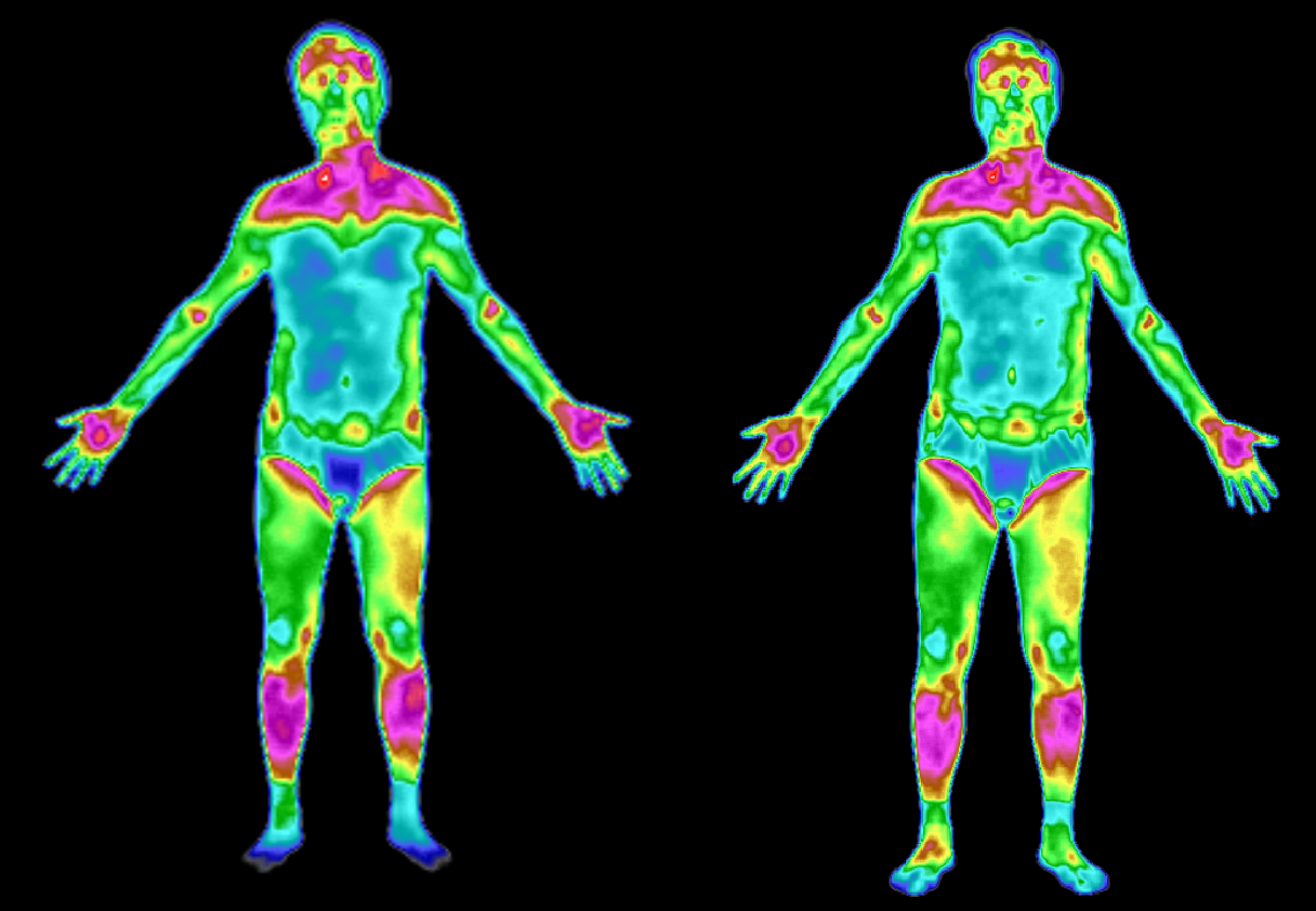 医用红外热成像在临床科室的应用-华景康热成像健康管理官网