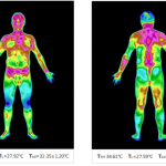 中医、治未病科建设的特色技术—医用红外热成像