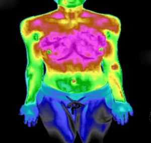 红外热成像技术在医学领域的应用概述