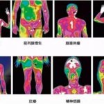 您的健康,温度知道——医用红外热像仪,一眼看穿您的健康状况 您的健康,温度知道——医用红外热像仪,一眼看穿您的健康状况