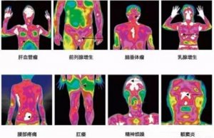您的健康，温度知道——医用红外热像仪，一眼看穿您的健康状况