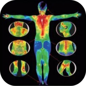 医用红外热像仪在血管相关疾病诊断评估中的运用