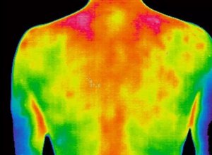 中医热CT-便携式医用红外热像仪