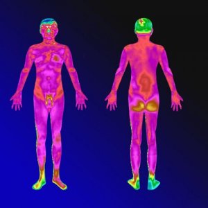 红外热成像仪引领体检新概念