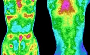 医用红外热成像检测技术的应用及作用