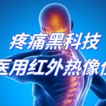 疼痛黑科技-医用红外热像仪 疼痛黑科技-医用红外热像仪