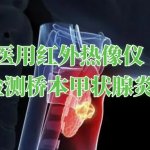 医用红外热像仪在女性桥本甲状腺炎中的应用 医用红外热像仪在女性桥本甲状腺炎中的应用