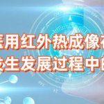 医用红外热成像在肿瘤发生发展过程中的应用 医用红外热成像在肿瘤发生发展过程中的应用