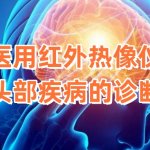 医用红外热像仪对头部疾病的诊断 医用红外热像仪对头部疾病的诊断