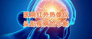 医用红外热像仪对头部疾病的诊断