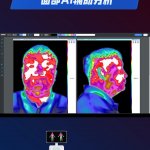 华景康红外面部AI辅助分析 华景康红外面部AI辅助分析